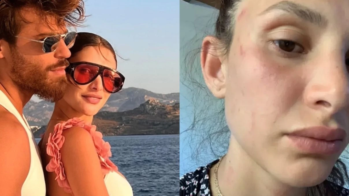 can yaman in sevgilisine ne oldu can yaman in sevgilisini kim dovdu 4