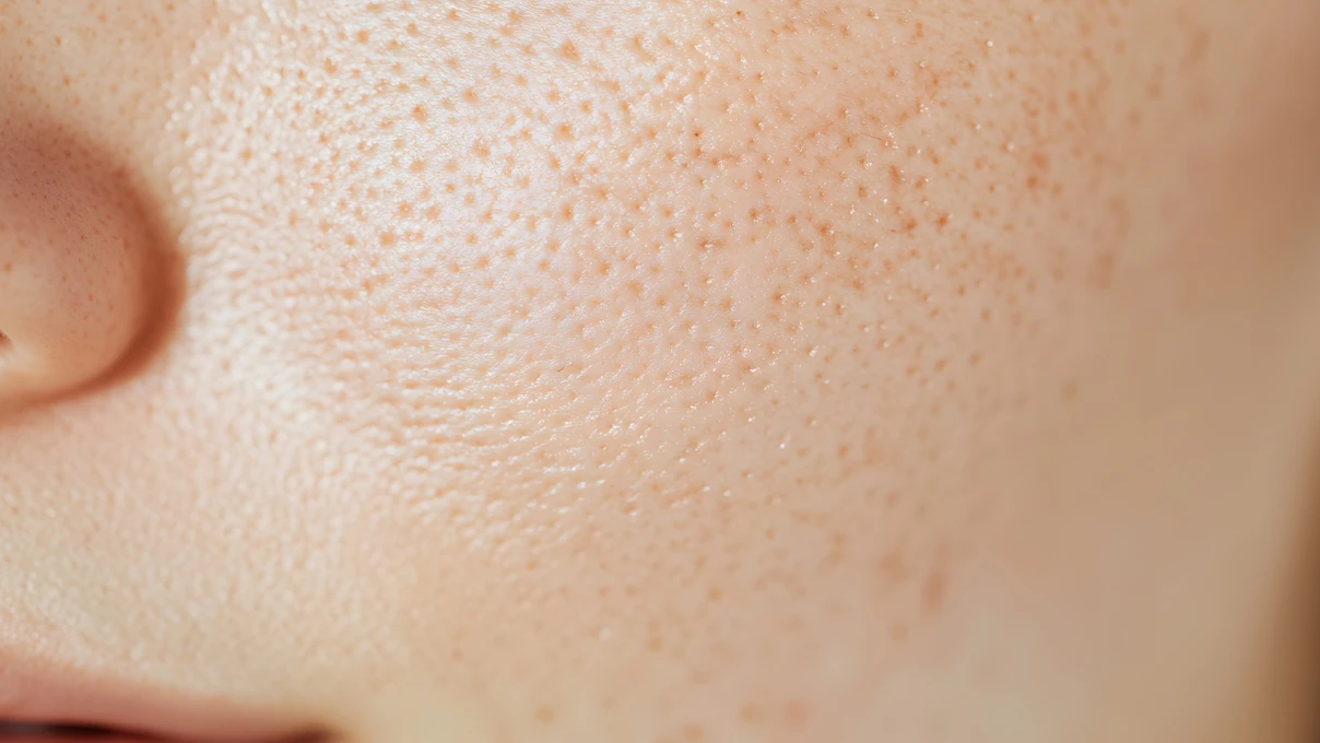 Kadınlar bu ay en çok gözenek küçülten markaları aradı! 4 cilt bakimi 1 2