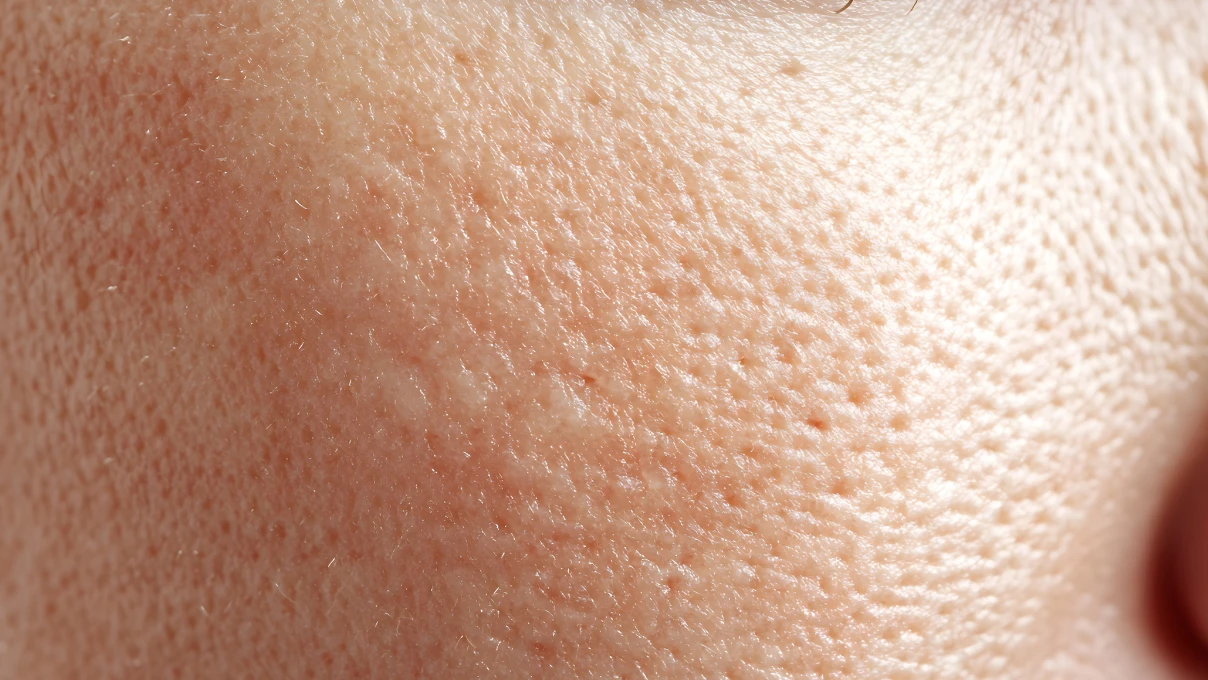 Kadınlar bu ay en çok gözenek küçülten markaları aradı! 8 cilt bakimi 7 1