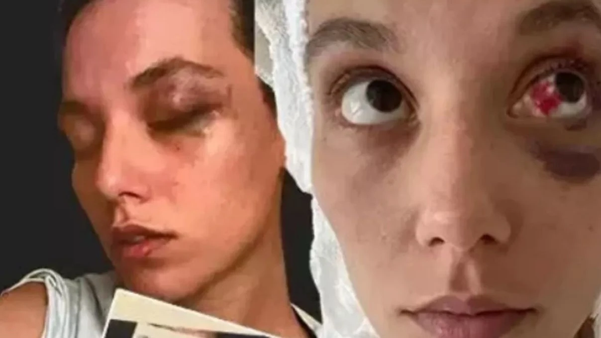 Deniz Bulutsuz ve Ozan Güven olayı nedir? Ozan Güven tutuklandı mı? 5 Deniz Bulutsuz ve Ozan Güven olayı nedir? Ozan Güven tutuklandı mı?