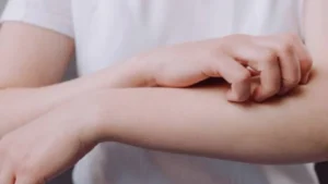 İbn-i Sina’dan kaşıntıya kesin çözüm! Hem suyu hem de kendisi oldukça faydalı 5 kasintiya naneli cozum kasintiya karsi oneri hem pisirin hem suyunu kullanin diyor iste formul kullanim suresi 0c088b