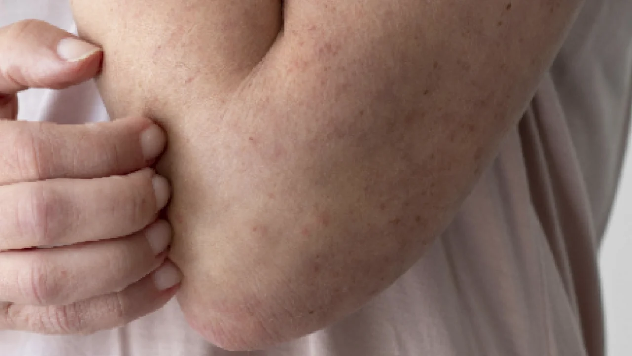 İbn-i Sina’dan kaşıntıya kesin çözüm! Hem suyu hem de kendisi oldukça faydalı 10 kasintiya naneli cozum kasintiya karsi oneri hem pisirin hem suyunu kullanin diyor iste formul kullanim suresi deef69