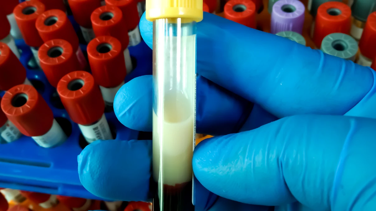 lipodem 1
