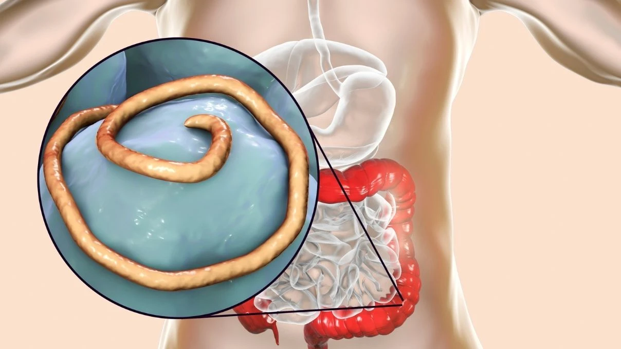 Parazitler bu sütten nefret ediyor! Sadece tek malzemeyle sindirim sisteminizi temizleyin