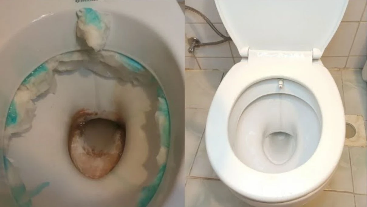 sararmis klozet nasil temizlenir