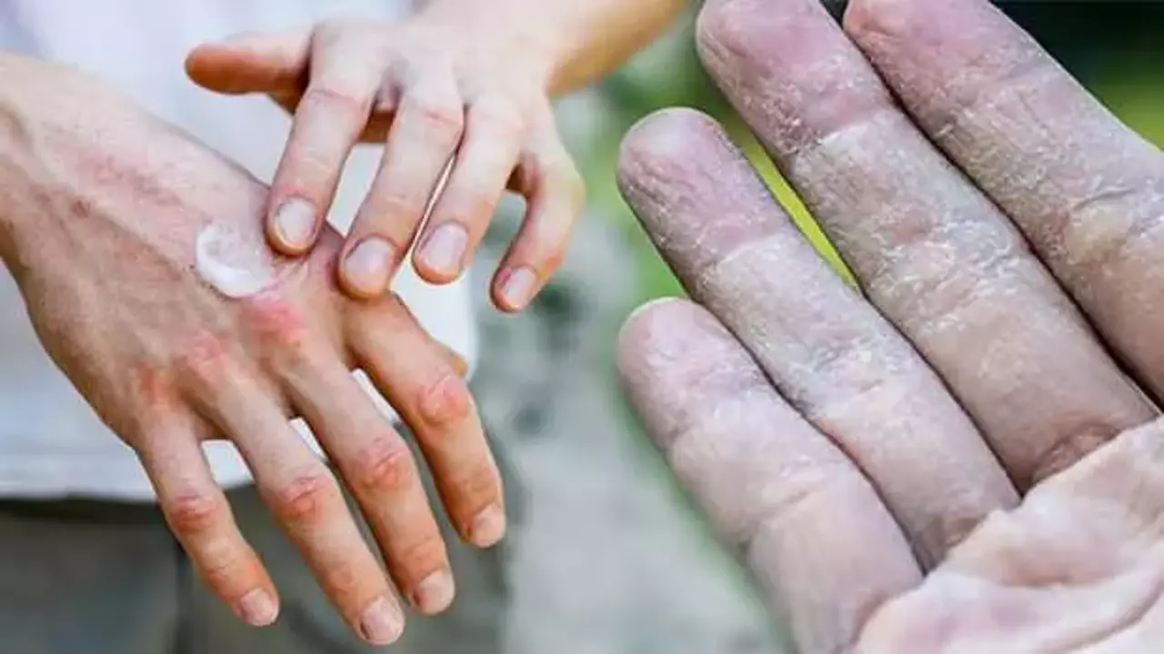 soguk havalarda artisa geciyor egzamaya dikkat 1641282502 7125