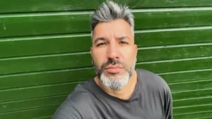 tolga akis
