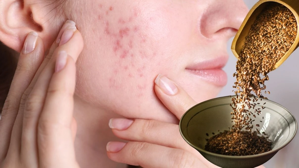 Yüzünüzdeki lekelere son! Sadece 2 malzemeyle çözüm çok basit