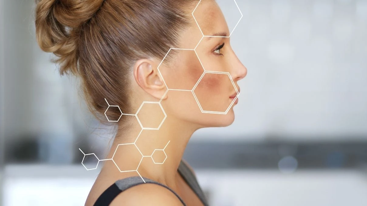 Yüzünüzdeki lekelere son! Sadece 2 malzemeyle çözüm çok basit